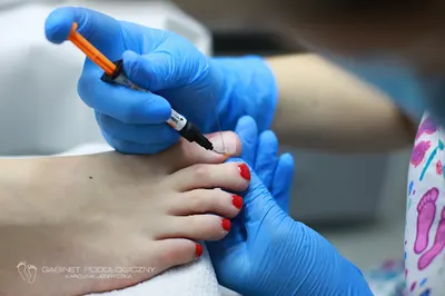 Gabinet Podologiczny Karolina Jędryczka I Podolog Poznań